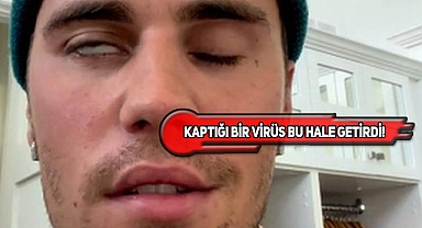 Kanadalı Şarkıcı Justin Bieber Yüz Felci Oldu!