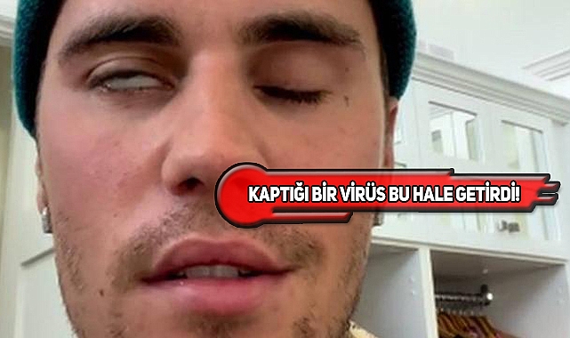 Kanadalı Şarkıcı Justin Bieber Yüz Felci Oldu!