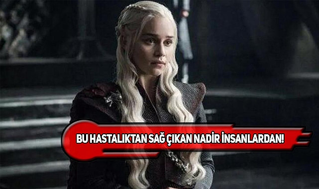 Game Of Thrones Yıldızı Beyin Anevrizması Atlatmış