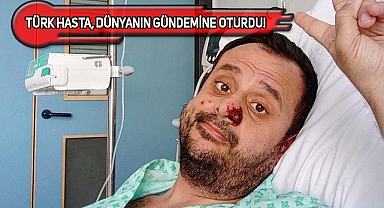 Maymun Çiçeğine Yakalanan Türk, DSÖ'nün Gündeminde