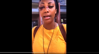 Olimpiyat Madalyalı Voleybolcuyu Kör Eden Saldırı