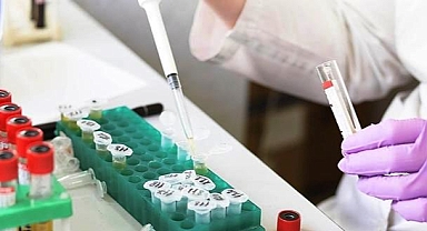 Maymun Çiçeği Aşısına 11 Milyon Dolarlık Anlaşma