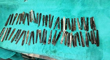 Karın Ağrısı Şikayetiyle Gitiği Hastanede Doktorları Şaşırttı