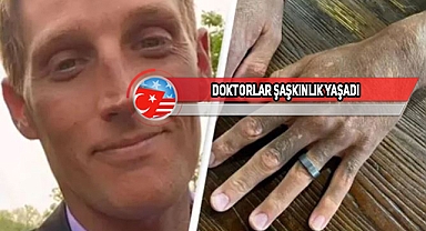 ABD'de Antidepresan, Adamın Rengini Griye Çevirdi