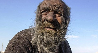 67 Yıldır Yıkanmıyordu, Duş Alınca Öldü