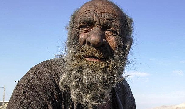 67 Yıldır Yıkanmıyordu, Duş Alınca Öldü
