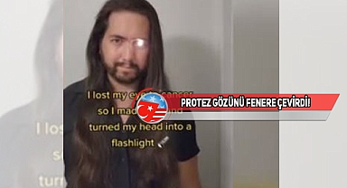 Californialı Adam Kaybettiği Gözü İle İlgi Odağı Oldu!