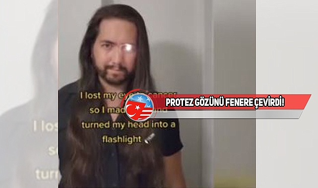 Californialı Adam Kaybettiği Gözü İle İlgi Odağı Oldu!
