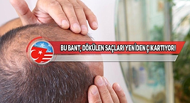 Bilim İnsanlarından Kellere, Saçı Dökülenlere Müjde!