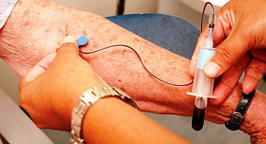  Alzheimer'ı Teşhis Eden Kan Testi Geliştirdi