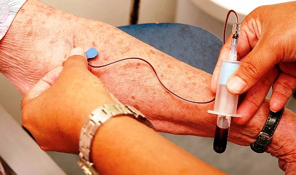 Alzheimer'ı Teşhis Eden Kan Testi Geliştirdi