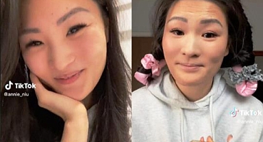 Ölen İkizinin Yerine Geçti Hikayesi Yürek Burktu