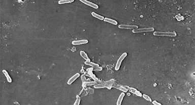 ABD'de Göz Damlasındaki Bakteriden Ölü Sayısı Artıyor