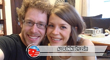 ABD'de Kocasına Alerjisi Olan Kadın!