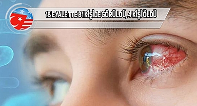 ABD'yi Alarma Geçiren Yeni Bakteri!