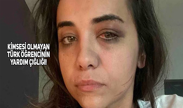 Türk Öğrenci ABD'de Ciddi Bir Trafik Kazası Geçirdi