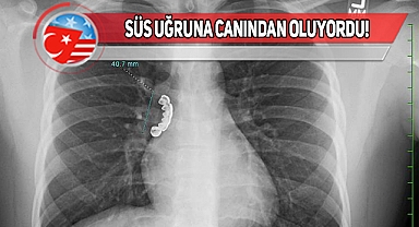 Wisconsin'da Protez Dişler Akciğere Saplandı