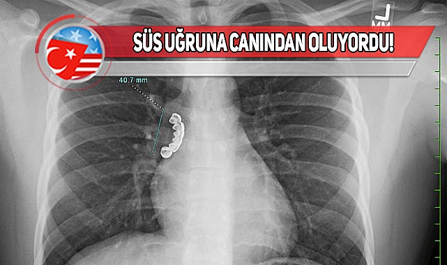 Wisconsin'da Protez Dişler Akciğere Saplandı