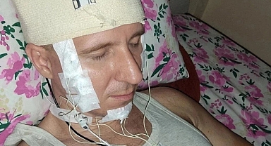 Kafasını Matkapla Deldi, Ölümden Döndü