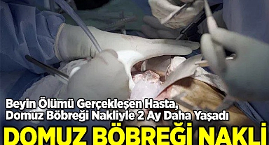 Domuz Böbreği Nakli