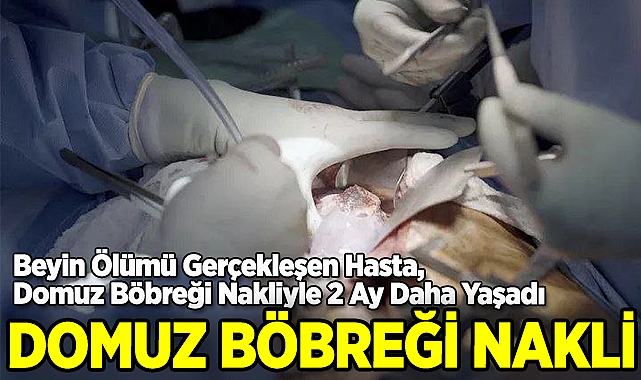Domuz Böbreği Nakli
