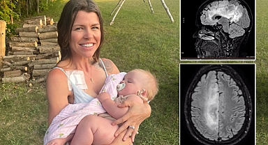 Kanser hastası hamile kadının büyük fedakarlığı: Tedavi ve kürtajı reddetti, bebeğini dünyaya getirdi