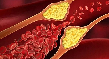 Gen aşısı ile kalp krizini önlemek artık mümkün!