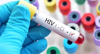 Dünya genelinde azalan AIDS, Türkiye'de 10 kat arttı