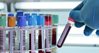 Yeni kan testi: Organların hangi hızda yaşlandığını tespit edebilecek