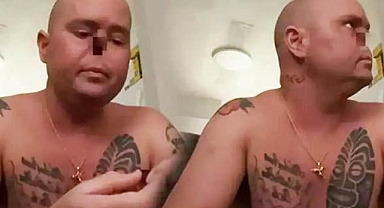 Bir grip tüm hayatını mahvetti: Burnunun tamamını kaybetti