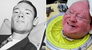 "Demir Akciğerdeki Adam" Paul Alexander, 78 yaşında hayatını kaybetti