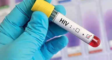 Hollanda'da HIV tedavisinde yeni umut: Hücreden ayırma denemesi başarılı
