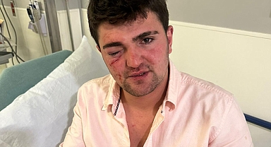 Ağrı'dan ABD'ye Gelen Mertkan Alptekin, Başka Bir Göçmen Tarafından Darp Edildi!