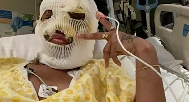 Kansas'ta Genç Kıza Asit Saldırısı: İki Şüpheli Tutuklandı