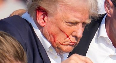 Suikast Girişimi Trump'ın Ruh Sağlığını Nasıl Etkiler?