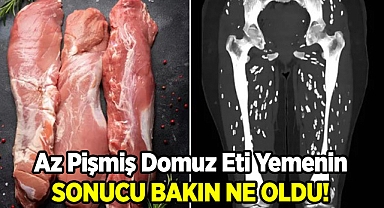 Az Pişmiş Domuz Eti Yedikten Sonra Bacakların Hali