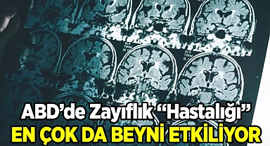 Zayıflık En Çok Da Beyni Etkiliyor!