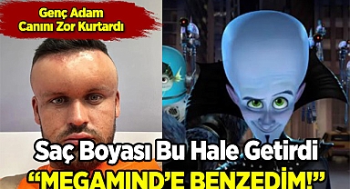 Saç Boyası Reaksiyonu Adamı 'Megamind'a Benzetti