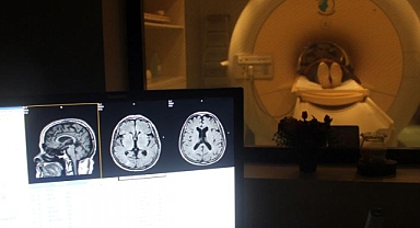 Amerika'daki Türk Doktorlardan Tümör İle Alakalı Yeni Keşif