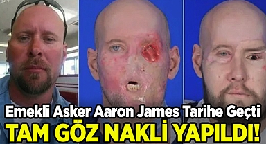 Emekli Asker Aaron James Tarihe Geçti: Dünyadaki İlk Tam Göz Nakli!