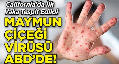  California'da İlk Vaka Tespit Edildi: Maymun Çiçeği Virüsü ABD'de Görüldü!