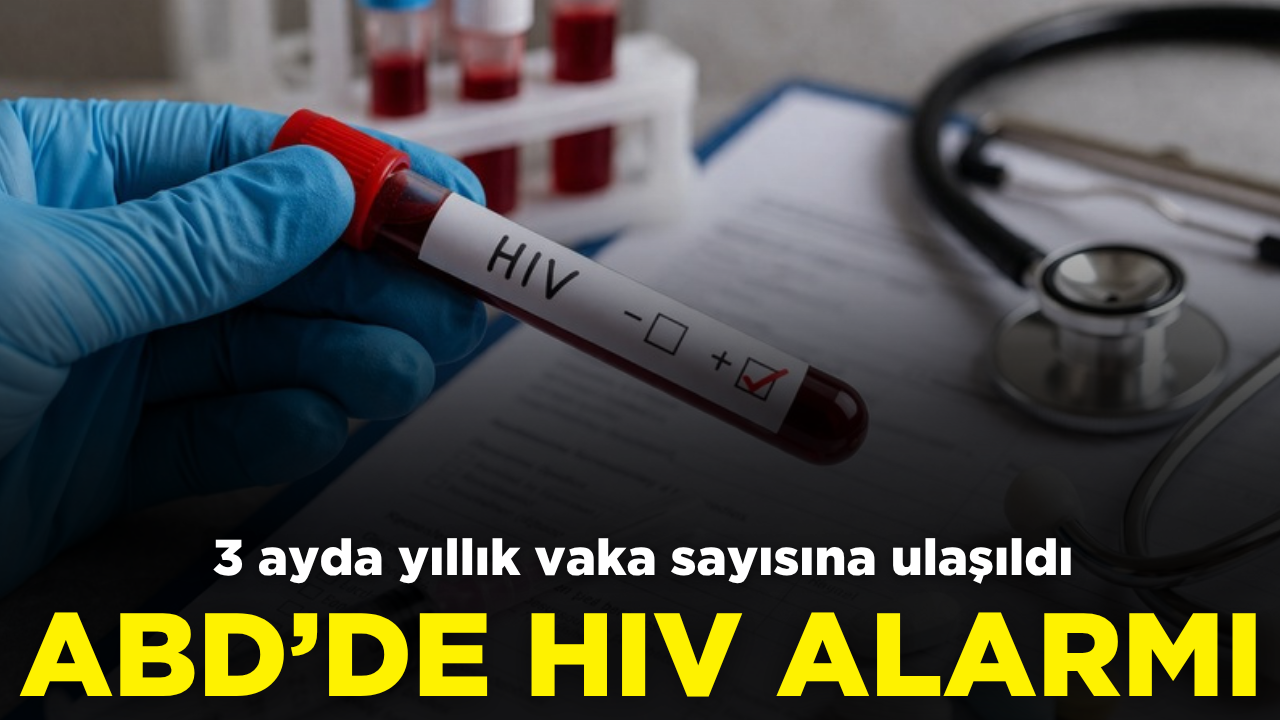 ABD'de HIV alarmı: 3 ayda yıllık vaka sayısına ulaşıldı