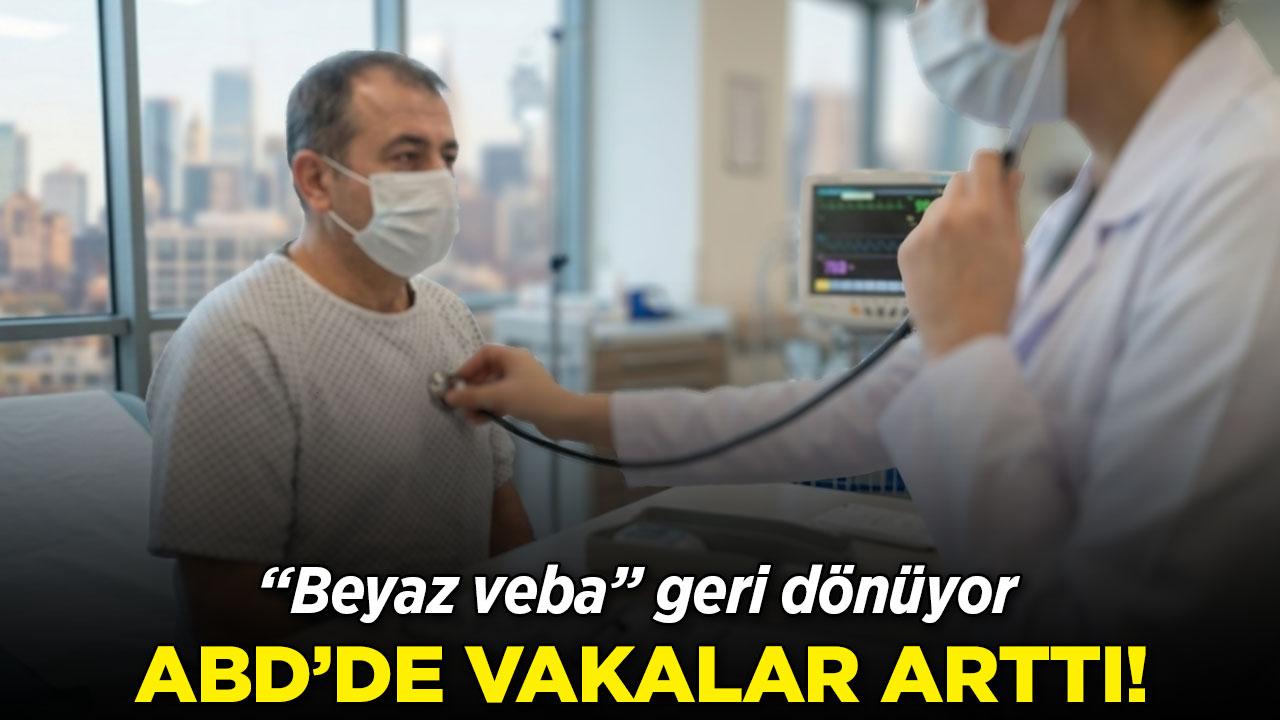 ABD'de tüberküloz vakalarında artış alarmı