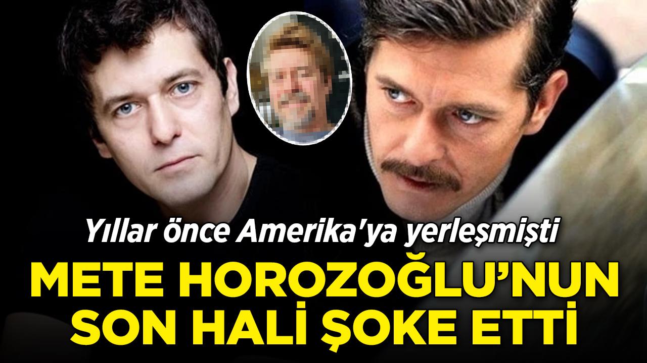 ABD'ye yerleşen Mete Horozoğlu'nun son hali viral oldu