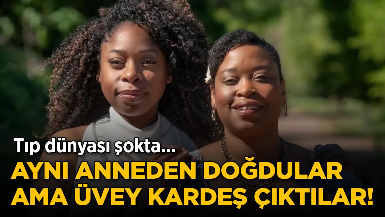 İngiltere'de şaşkına çeviren DNA sonucu! İkiz kardeşlerin babaları farklı çıktı
