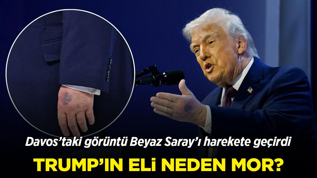 Donald Trump'ın moraran eli yeniden tartışma yarattı
