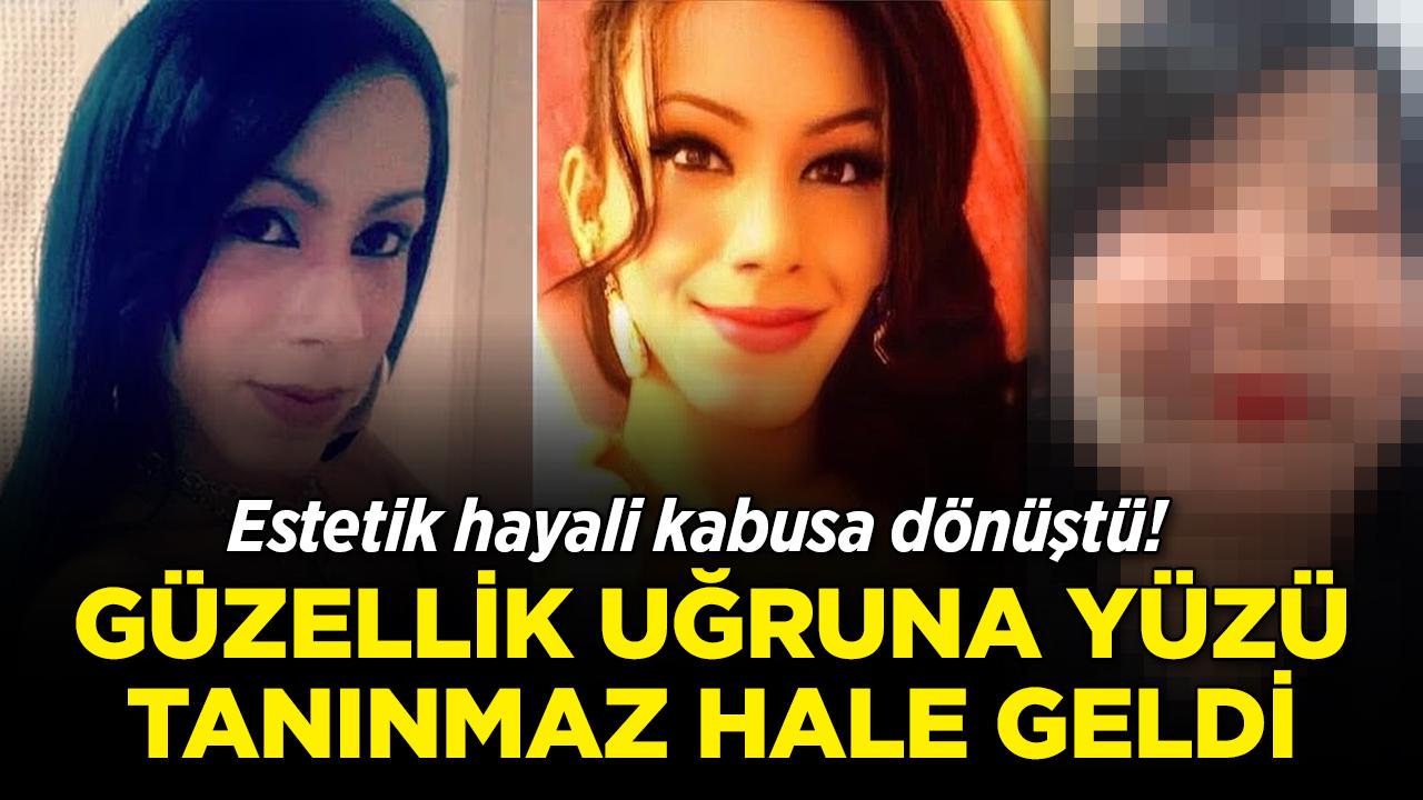 Estetik hayali kabusa dönüştü! Güzellik uğruna yüzü tanınmaz hale geldi